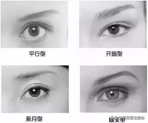 关于双眼皮你应该知道的有哪些,做双眼皮必须知道的三件事