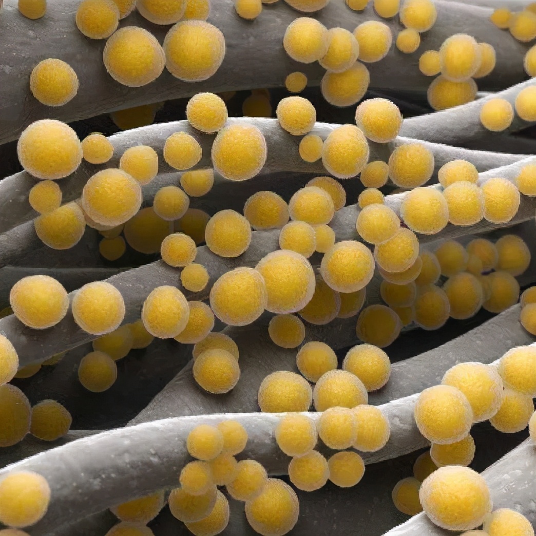 儿童金黄色葡萄球菌是怎么感染的,金黄色葡萄球菌的致病物质