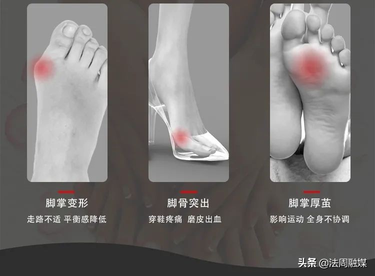 拇指长歪了?别慌!常德市第一中医医院专家帮您改“邪”归正