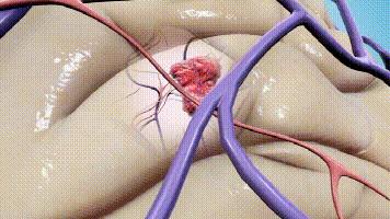 深圳市人民医院黄智勇,人民医院黄智勇