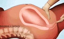 手剥胎盘有多痛可以打麻药不,手剥胎盘会肚子疼吗