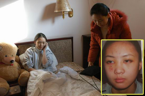 当年张默打童瑶的时候,张默打童瑶事件图片