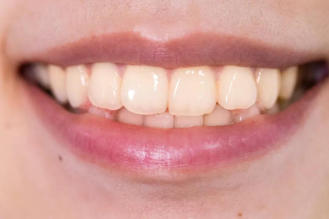 护牙釉质的牙膏叫什么牙膏,防蛀牙牙膏推荐前十名儿童