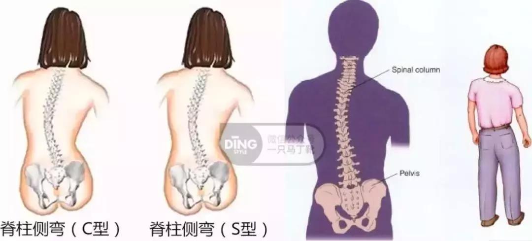 脸大小不对称怎么矫正,如何改善大小脸不对称