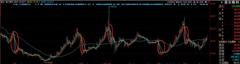 爱尔眼科涨超14%股价创历史新高,爱尔眼科2019一季报