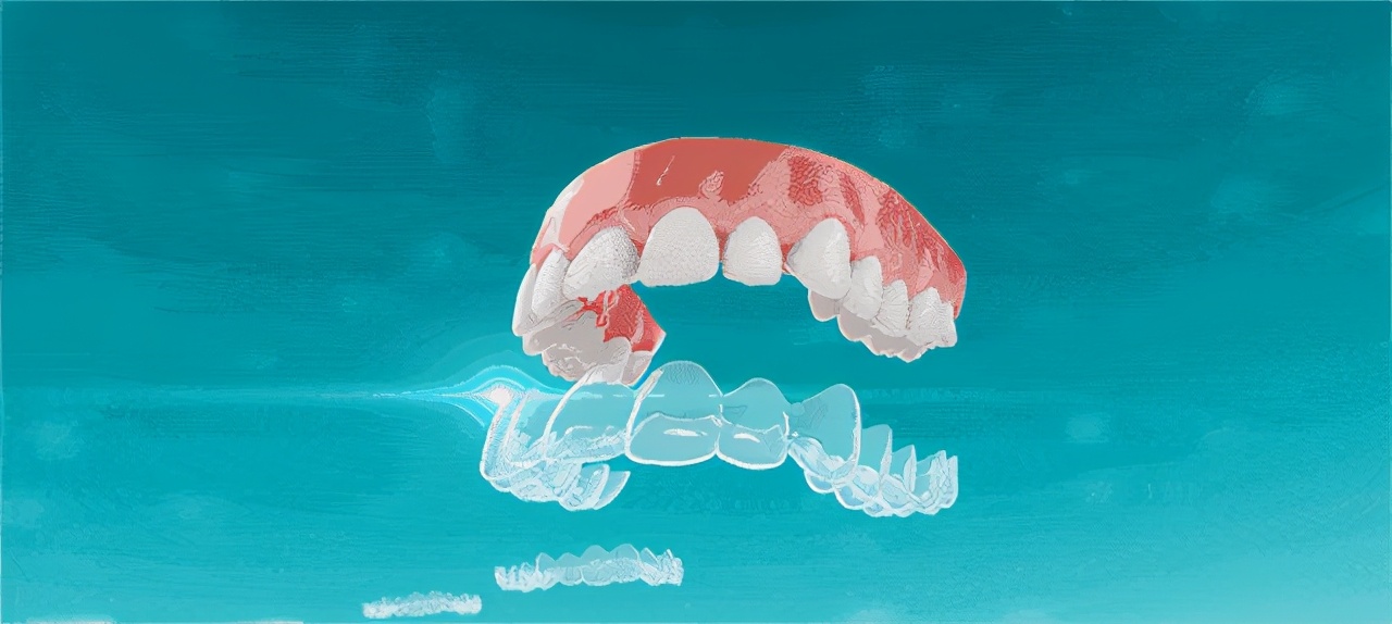 大连矫正牙齿的正确方法,大连齿医生口腔种植牙怎么样