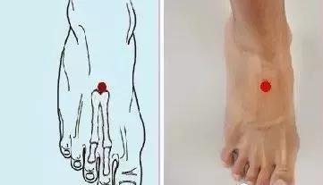 艾灸1小时，迅速提升下垂脸！简简单单就变美