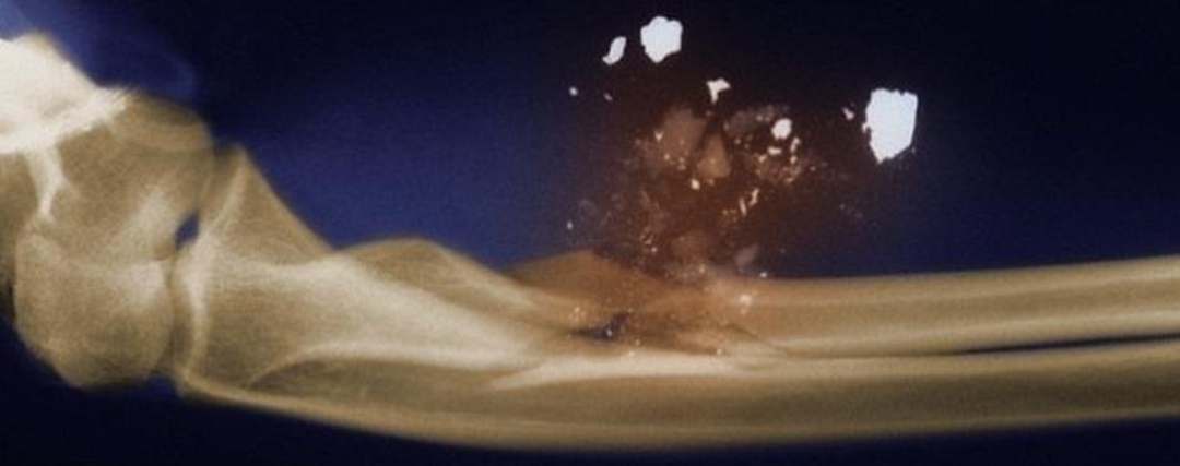 防弹衣中弹后还能用吗,防弹衣中弹后还能继续用吗