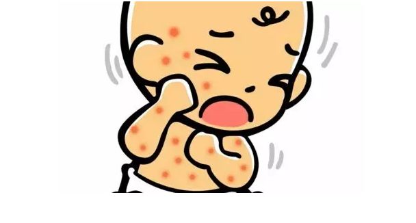 儿童食物过敏怎么办最快最有效,儿童蛋白过敏吃什么食物好