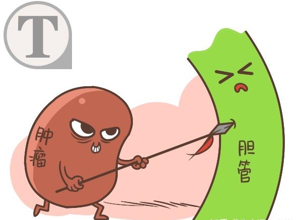 癌症眼部皮肤变色,皮肤黄眼睛黄是什么癌