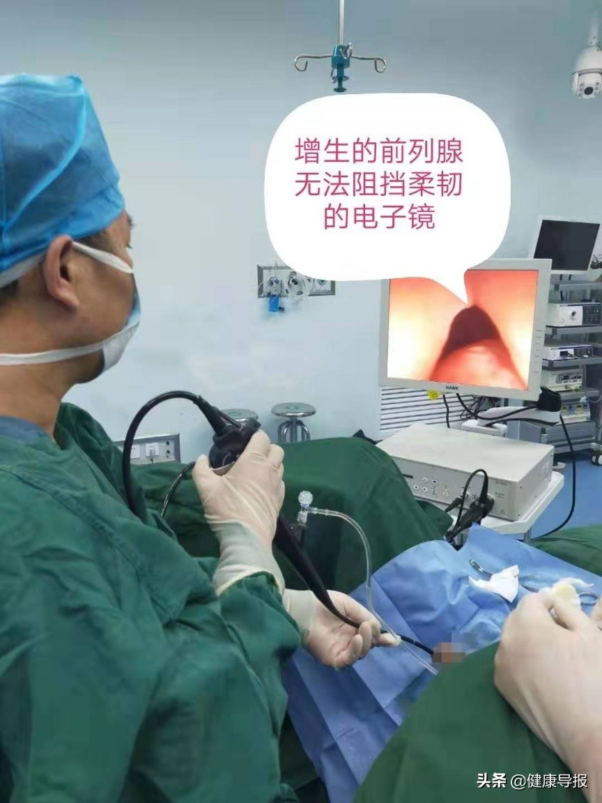 医用电子膀胱镜,膀胱电子软镜痛苦吗