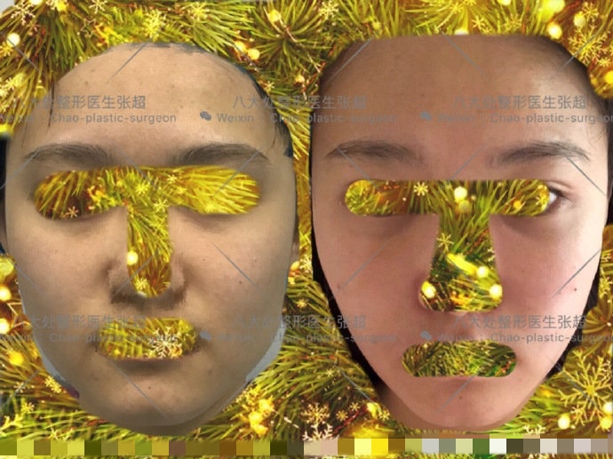 八大处整形张超,八大处张超最新视频