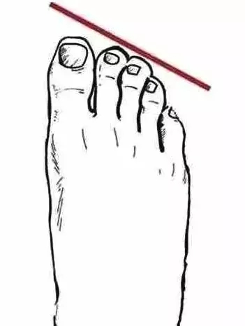 脚型不好看不敢穿凉鞋怎么办,什么脚型适合穿什么高跟凉鞋