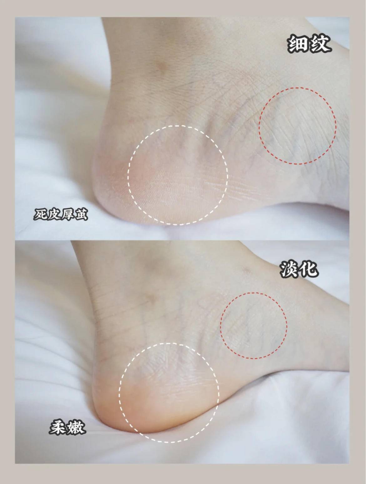 避免尴尬瞬间,避免尴尬的方式