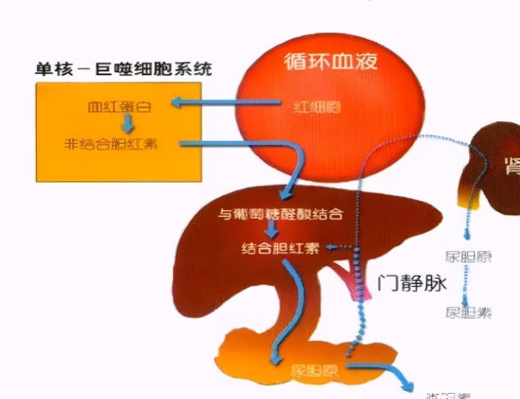 怎么远离黄疸,如何去掉黄疸的方法
