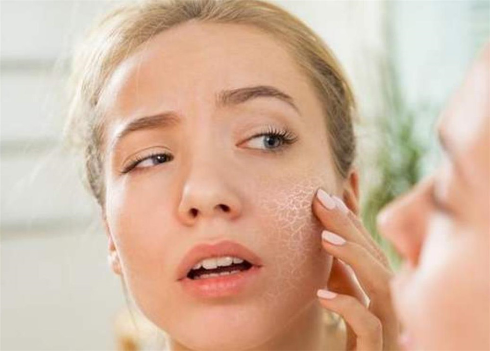 换季皮肤泛红发痒怎么快速解决,春季换季皮肤干燥过敏泛红刺痛