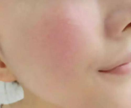 敏感肌护肤日记,敏感肌的护肤日记