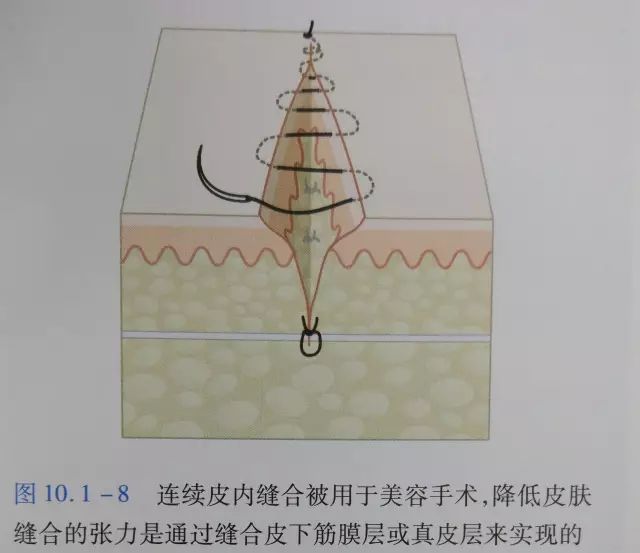 伤口闭合的正确方法,伤口清创的详细步骤