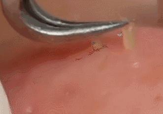 收缩毛孔的7个专家建议,收缩毛孔的最好方法一个月