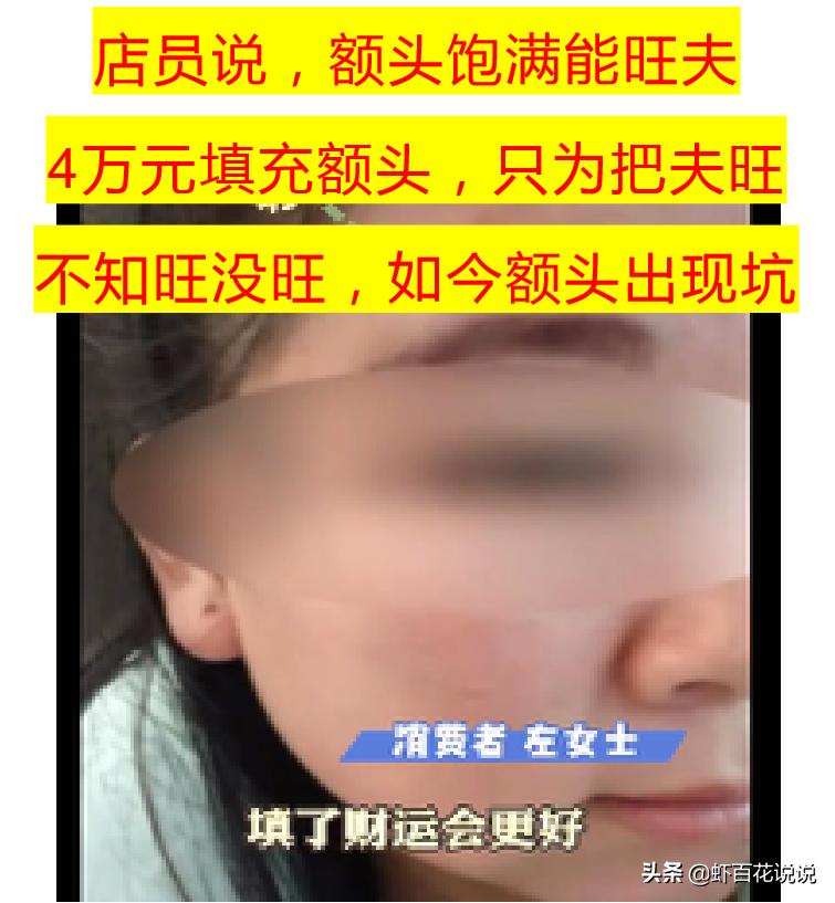 额头正中凹陷是富贵坑吗怎么填充,女人填充太阳穴改变运势