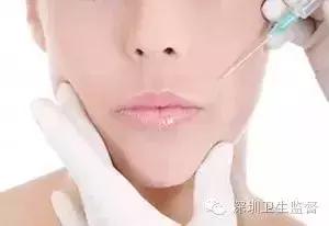 超声刀美容可重复做吗,超声刀美容能常做吗