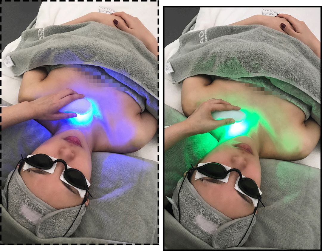 花3000块做一次皮肤护理，我后悔吗？