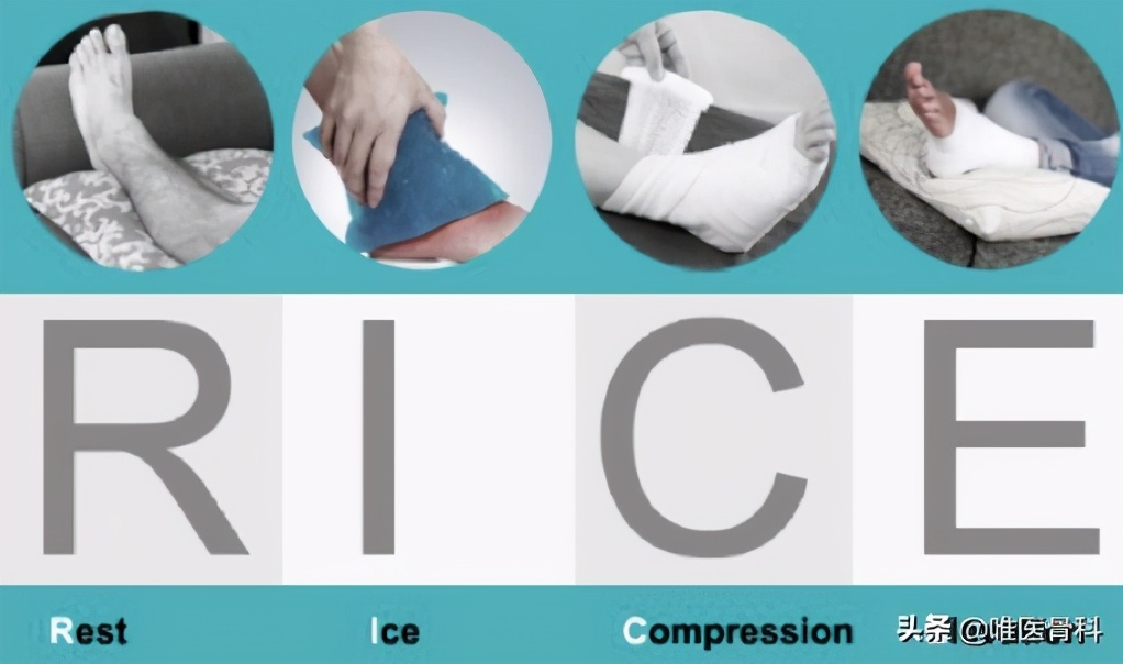 崴脚之后要立刻活动,崴脚了该不该活动