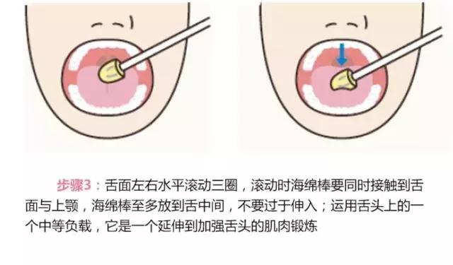 opt口肌评估,opt面部提拉