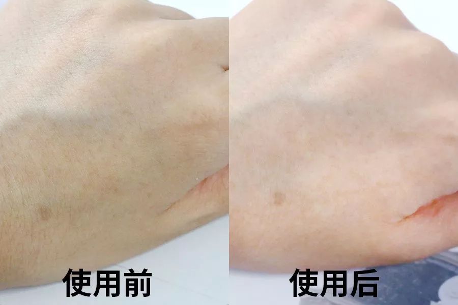 冬天手脚粗糙开裂小妙招,冬季手脚干裂怎么快速修复