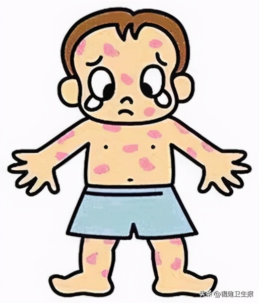 儿童泡过药浴全身像过敏一样,1岁宝宝泡药浴起疹子
