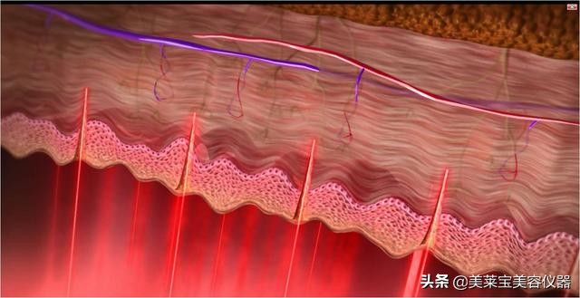 美容紧致仪器,日式美容护理仪器