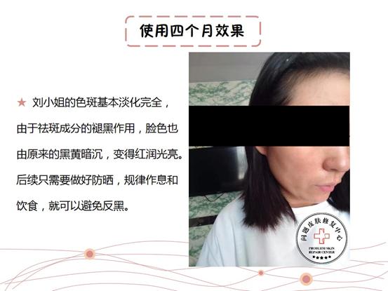 st皮肤修复中心在哪里,妊娠斑修复中心