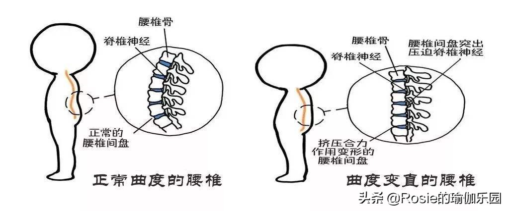 办公室久坐腰疼可以做哪些动作,久坐腰疼办公室缓解动作