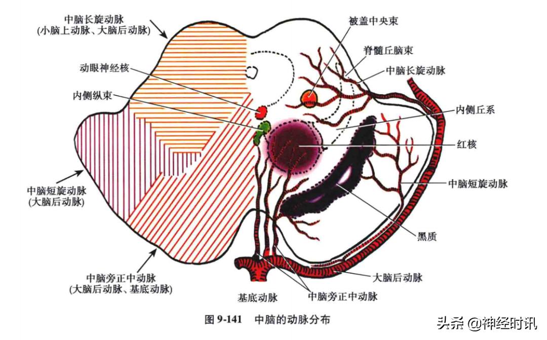 急性脑血管病的解剖诊断,脑的血液供应来源及脑血管的特点