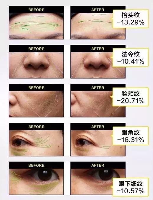 olay超a眼霜和露得清,olay超a眼霜有用吗