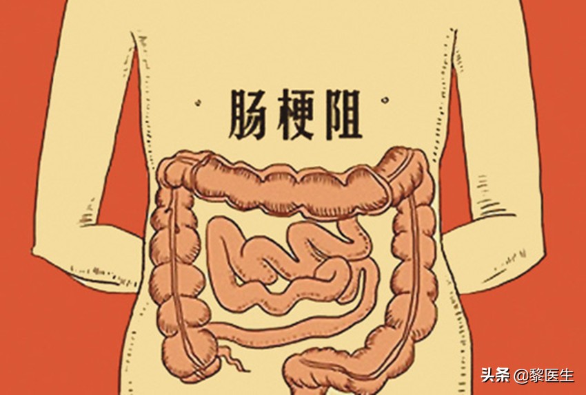 小肠恶性肿瘤跟直肠癌的区别,小肠癌小肠肿瘤的症状