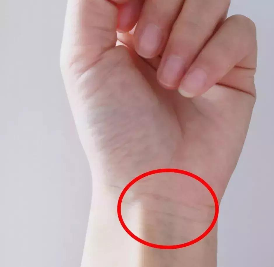 洗澡后手上的青筋暴露是什么原因,今天手上突然冒青筋是怎么回事啊