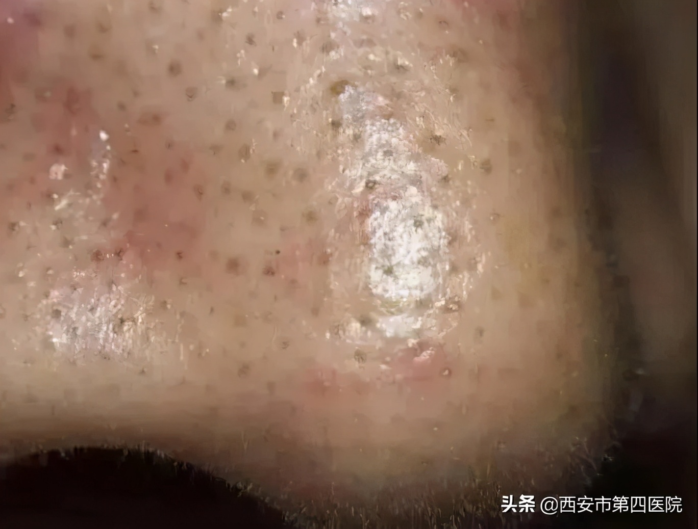 健康中国有哪些举措,健康中国行动攻略