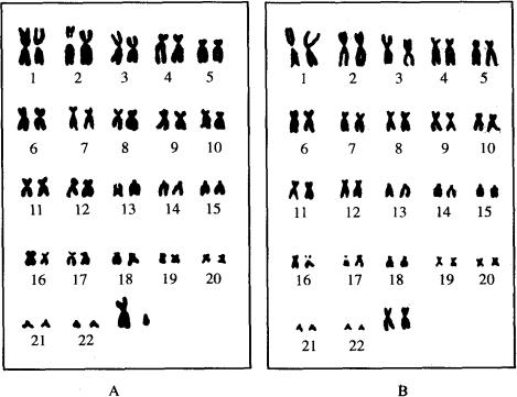 火化后的骨灰能检测dna吗,火化后骨灰中还有dna吗