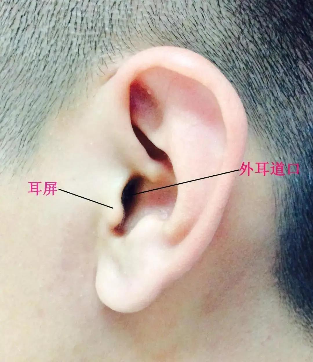 郑芸耳鸣彻底痊愈案例,华西医院郑芸谈脑鸣与耳鸣