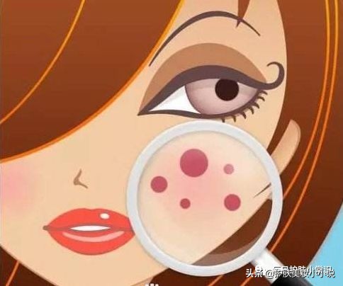 清鼻子毛孔后怎么护肤,什么护肤品改善毛孔粗大草莓鼻