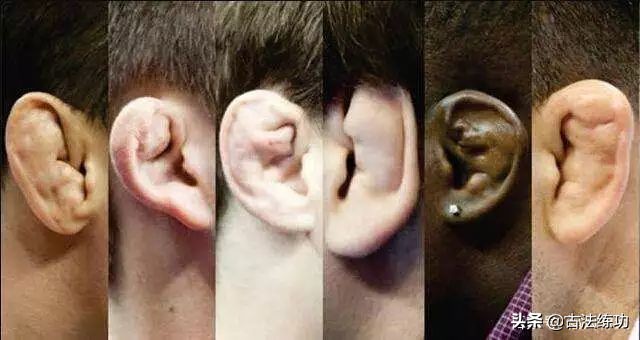 怎么看出一个人是否练拳击,没练过格斗的如何打败练过散打的