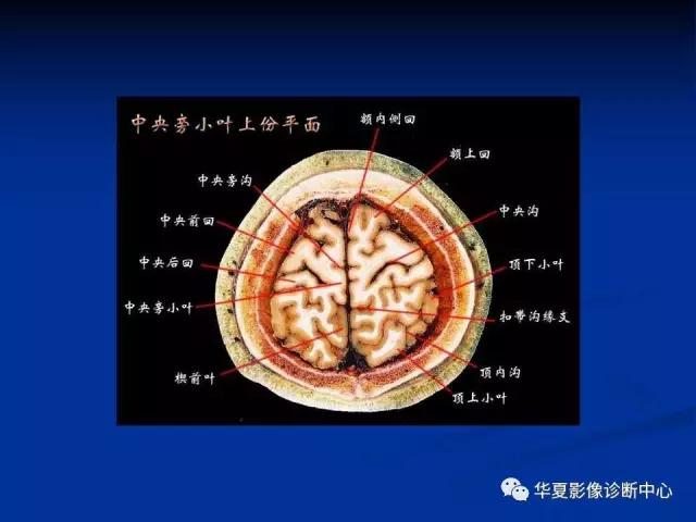 mra头颅解剖学详细讲解视频,常见的头颅mri图像