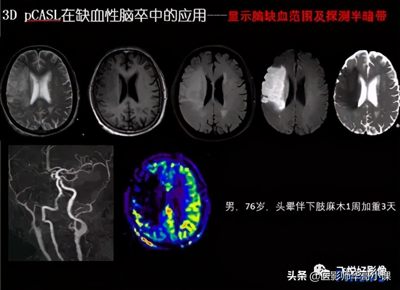 飞利浦磁共振快速扫描方案指南,飞利浦1.5t磁共振各部位扫描技术