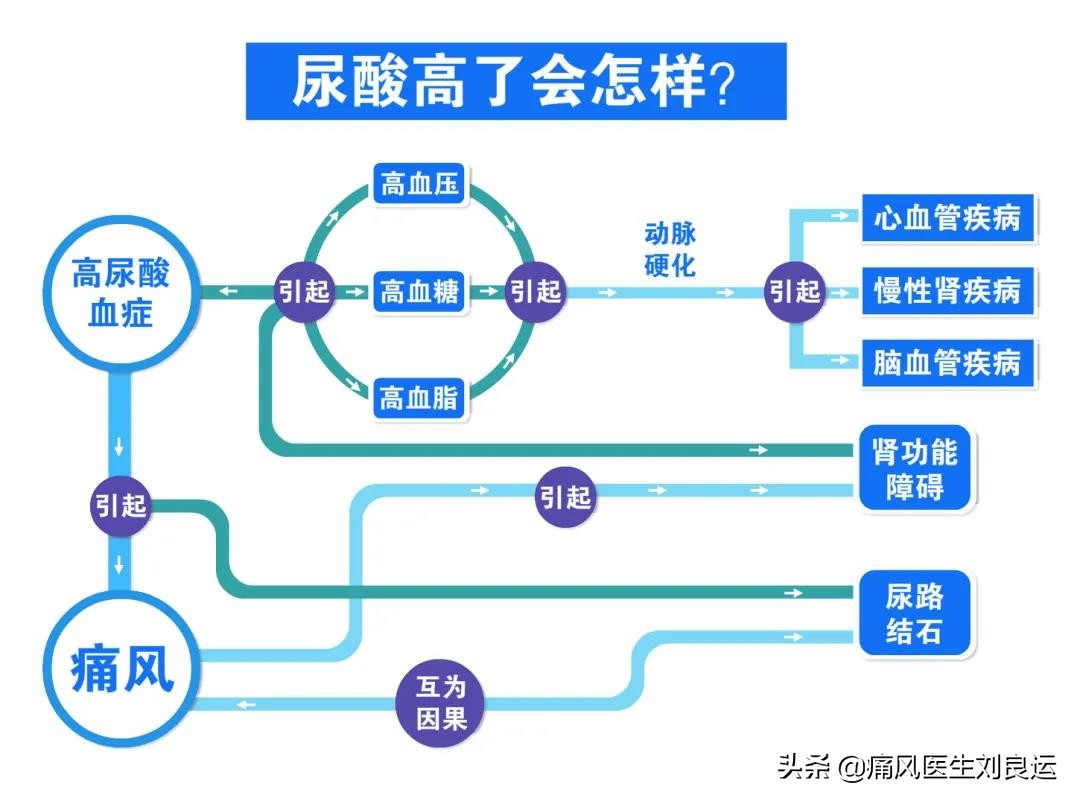 痛风不再痛一招降尿酸,痛风症状缓解后开始降尿酸治疗