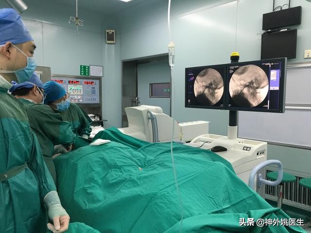三叉神经痛微创治疗方法,超微创定向修复三叉神经