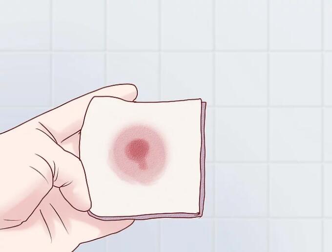 得了痔疮怎么办学会三招治痔疮,得了痔疮别担心这个小方法快试试