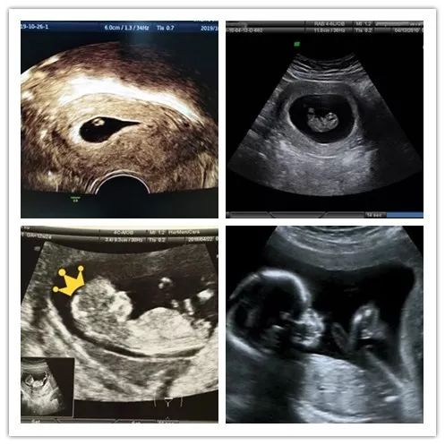 准妈准爸必看！超详细产检时间表