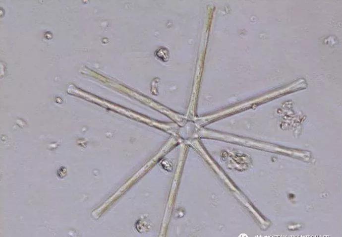 硅藻水,硅藻水和绿藻水区别