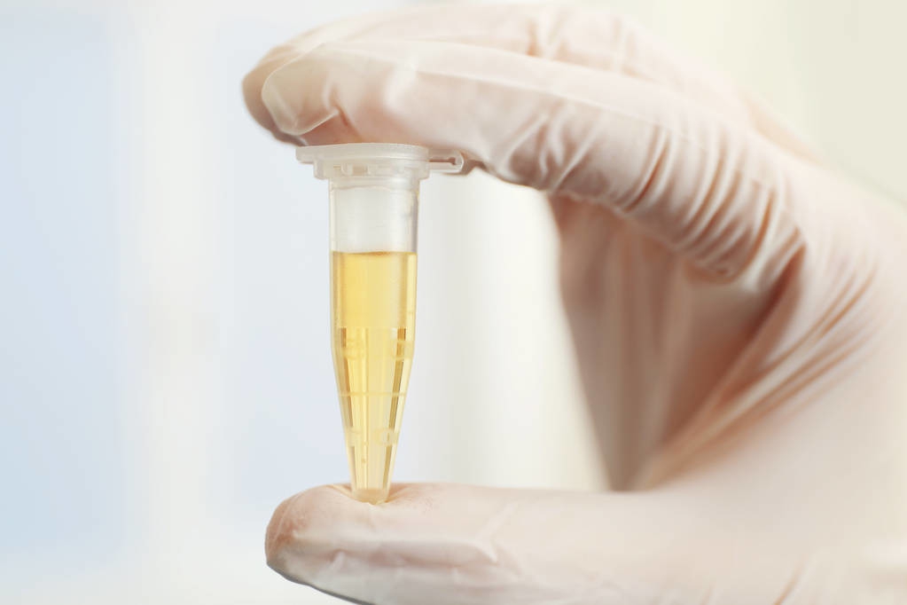 老年人小便浑浊有味是怎么回事,老年人尿浑浊怎么回事